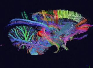 Illustration for article titled Amazing DSI Brain Scanning Visualizes Your Mind's Inner Workings In 3D